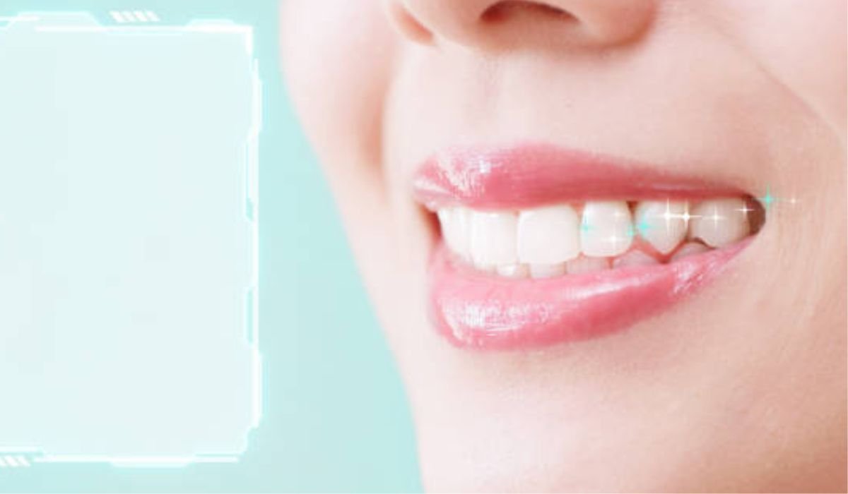 Digital Smile Design